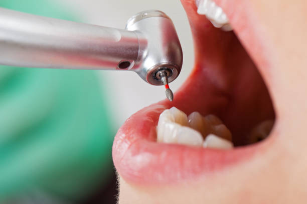 Best Cosmetic Emergency Dentistry in Edmond, OK